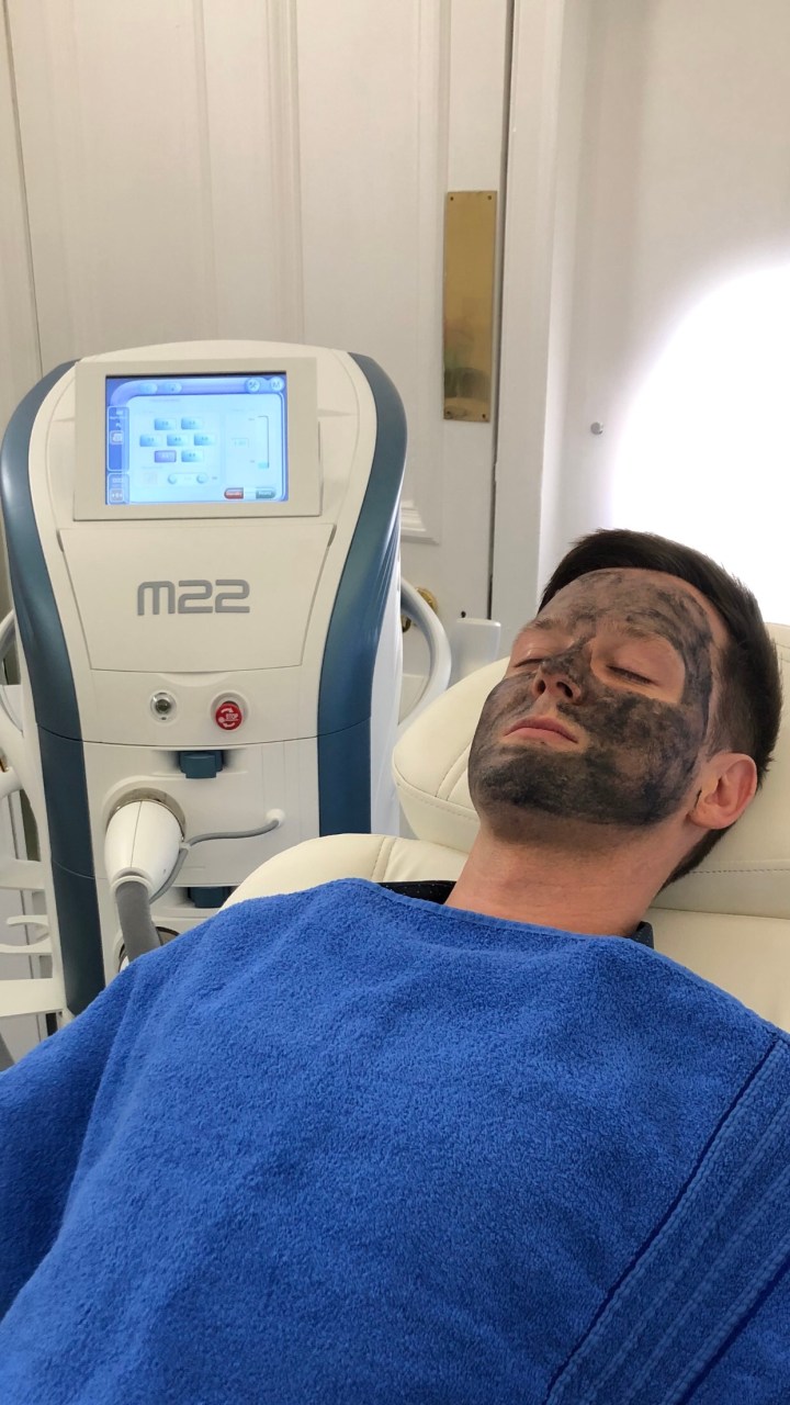 Carbon Laser Peel – Dr Nestor Medical & Cosmetic&nbsp;Centre